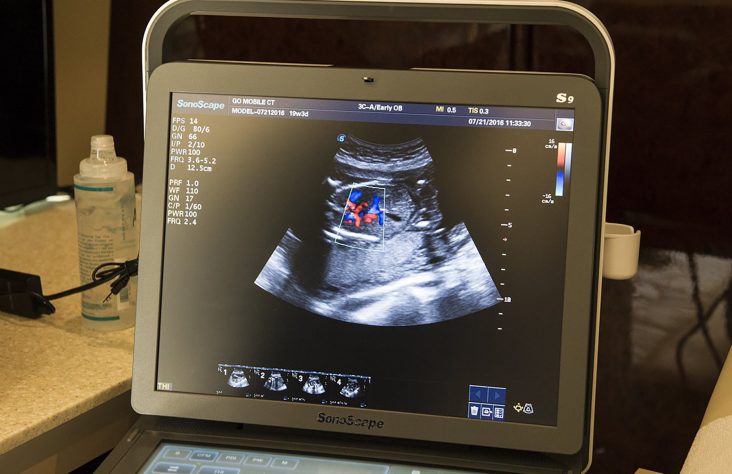 Doctors: Advances since Roe confirm abortion ‘takes life of unborn child’